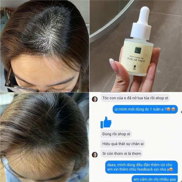 Combo 4 lọ - Feedback sau hơn 2 tháng