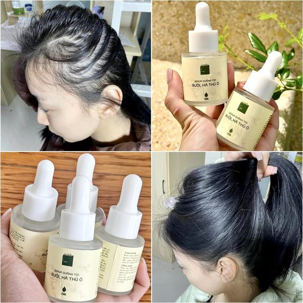 Trước - sau 4 tuần dùng serum